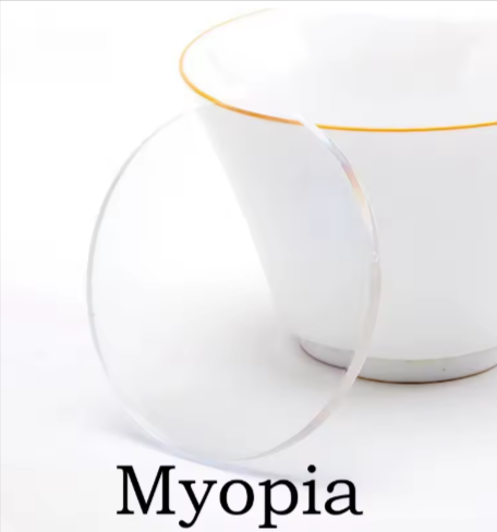 Xbora Single Vision HD Clear Lenses