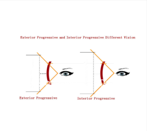 Brightzone 1.56 Index Exterior Progressive Multifocal Clear Lenses Lenses Brightzone Lenses   